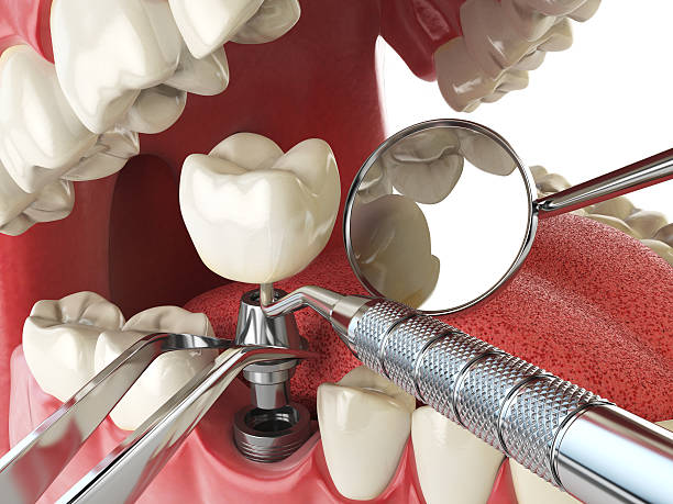 Best Emergency Dental Clinic in MT